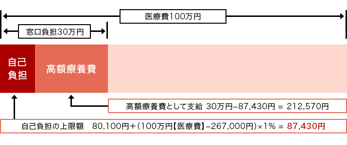 ����Ô�100���~ ���������S30���~[���ȕ��S:���ȕ��S�z�̏���z 80,100�~+�i100���~�y��Ô�z-267,000�~�j�~1%=87,430�~] [���z�×{��:���z�×{��Ƃ��Ďx�� 30���~-87,430�~ = 212,570�~]�� ��